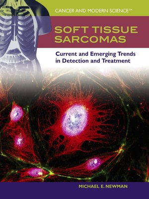 cover image of Soft Tissue Sarcomas